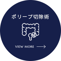 ポリープ切除術